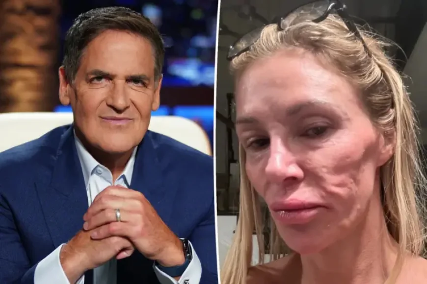 Mark Cuban Pharmacy Helped Brandi Glanville Cut Medication Costs Amid Facial Disfigurement Fight