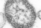 CDC Warns of Measles Surge Before Summer Travel