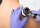 Cancer Research UK raises Melanoma warning after 20,980 UK diagnoses