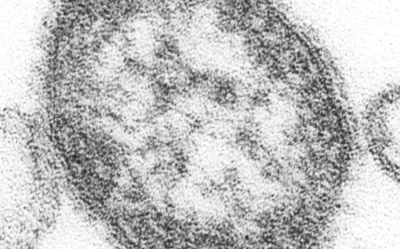CDC Warns of Measles Surge Before Summer Travel