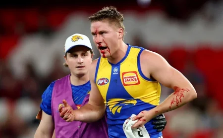 Harry Edwards Forced Off After Elliot Yeo Elbow Clash