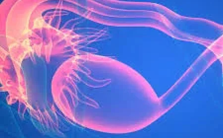 Teede Renames PCOS to Pmos After 14 Years