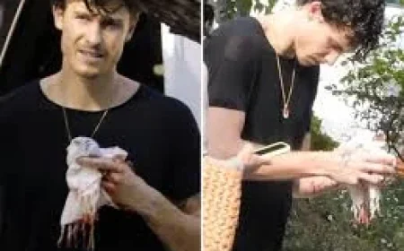 Shawn Mendes Shows Bloody Left-Hand Injury in Beverly Hills