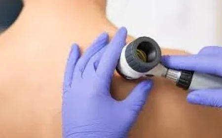 Cancer Research UK raises Melanoma warning after 20,980 UK diagnoses