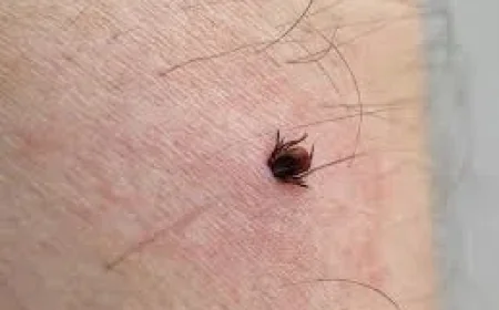 Montreal Warns on 161 Lyme Disease Cases in 2025