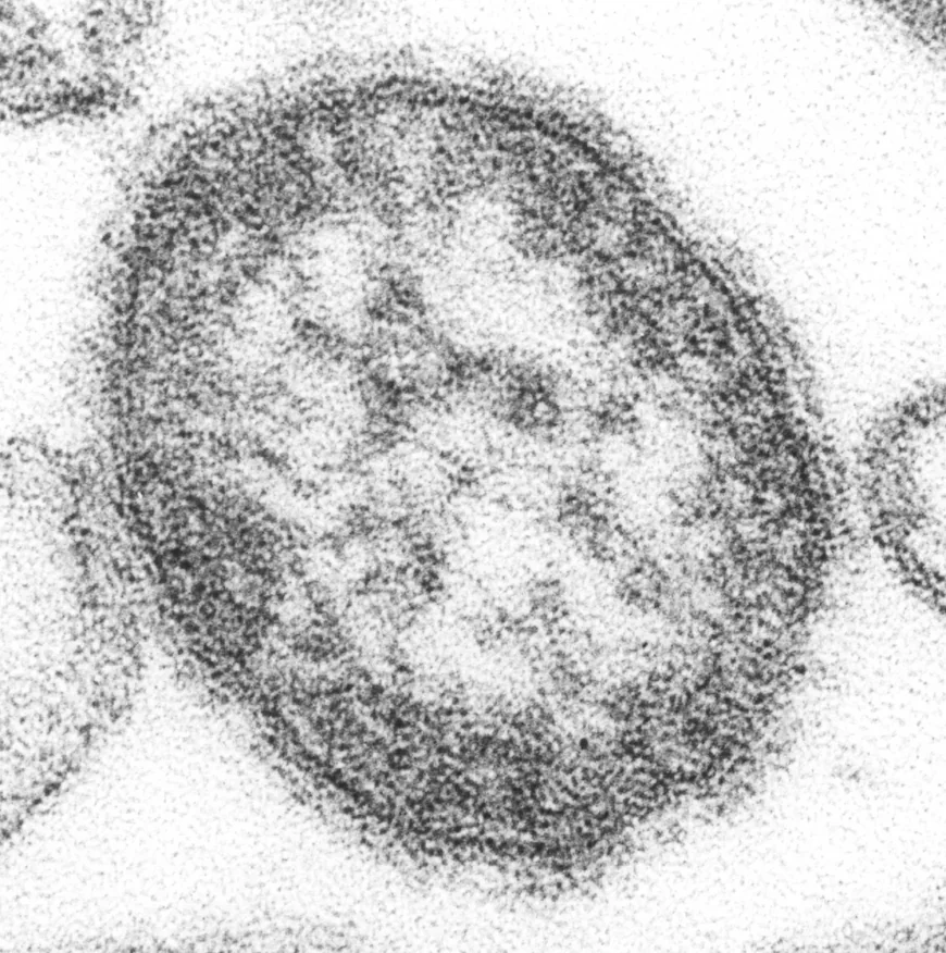 CDC Warns of Measles Surge Before Summer Travel