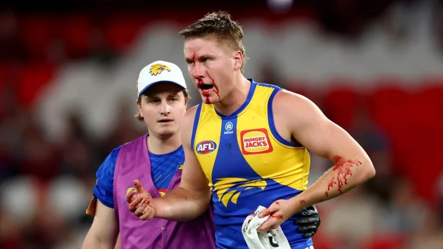 Harry Edwards Forced Off After Elliot Yeo Elbow Clash