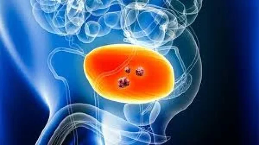 SMC Backs Metastatic Cancer Drug Pair for 200 Scots
