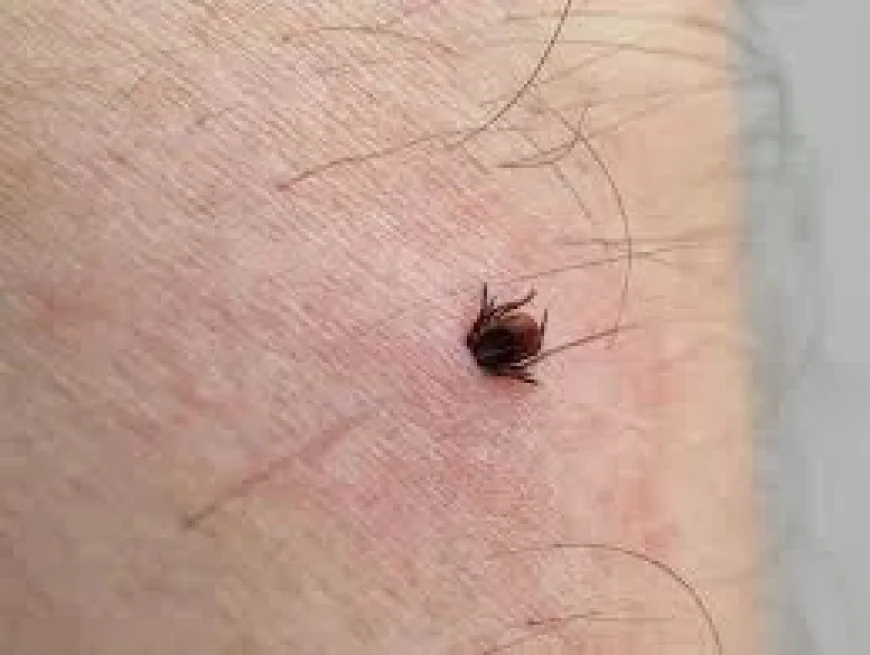 Montreal Warns on 161 Lyme Disease Cases in 2025