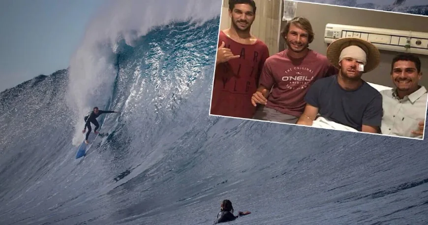 Nathan Bartlett Surfer Dies at Jervis Bay After Water Rescue