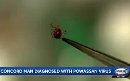 Powassan Virus Can Spread in 15 Minutes After Tick Attachment