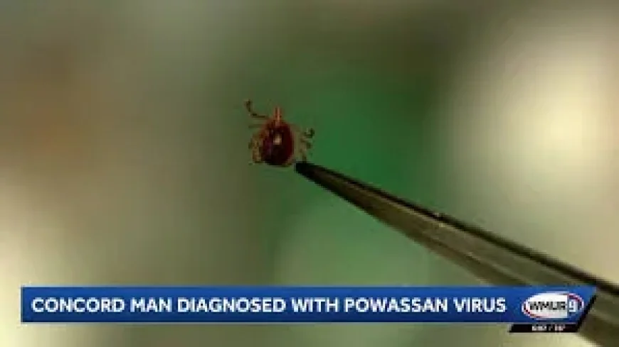 Powassan Virus Can Spread in 15 Minutes After Tick Attachment