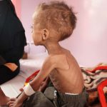 الصليب الأحمر: أكثر من 70٪ من اليمنيين بحاجة إلى مساعدات إنسانية