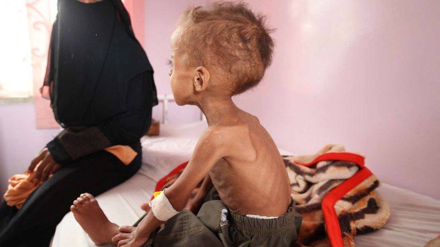 الصليب الأحمر: أكثر من 70٪ من اليمنيين بحاجة إلى مساعدات إنسانية